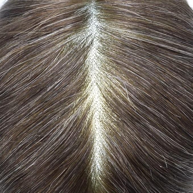 FACE MIRACLE Lace Front Mens Toupee Human Hair System Swiss Lace Center Toupee for Men Thin Skin PU Around Hair Replacement System V-Looped Mens Hair Wig Units 7"X9" #240 Darkest Brown with 40% Gray