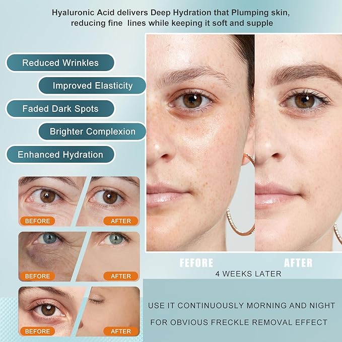 Super Vitamin C Face Serum, with Vitamin C, Hyaluronic Acid, Tripeptides, firms and lifts skin, Targets Dark Spots and Wrinkles, total package serum, Anti-Aging Formula for Mature Skin -1 fl. oz