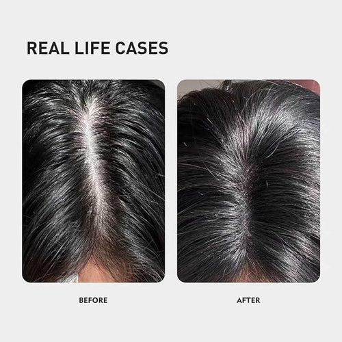 0.5% KX-826 DHT Blocker Hair Thickening Growth Products，Plant-Based Extract Essence Anti-Hair Loss Solution,Hair Spray,3 Days Oil Control 1-2 Weeks Hair Loss Reduction 3-6 Months New Hair Visible