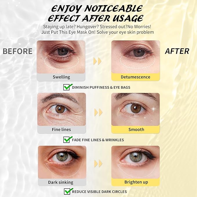 Under Eye Patches (30 Pairs), Hyaluronic Acid Eye Masks for Dark Circles Puffy Eyes Undereye Bags, Collagen Eye Patches for Wrinkles and Hydrate, Skin Care Gift for Her